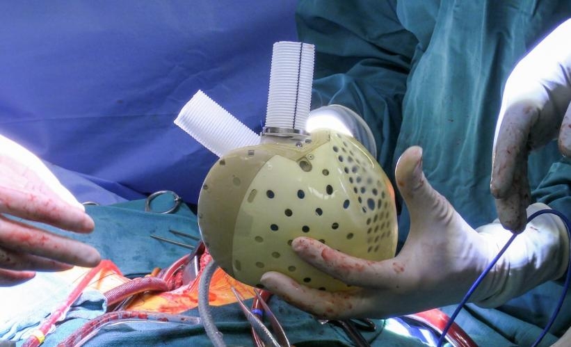 bec08f9bc67a61044d710c0fd375d2c8